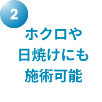 ホクロや日焼けにも施術可能